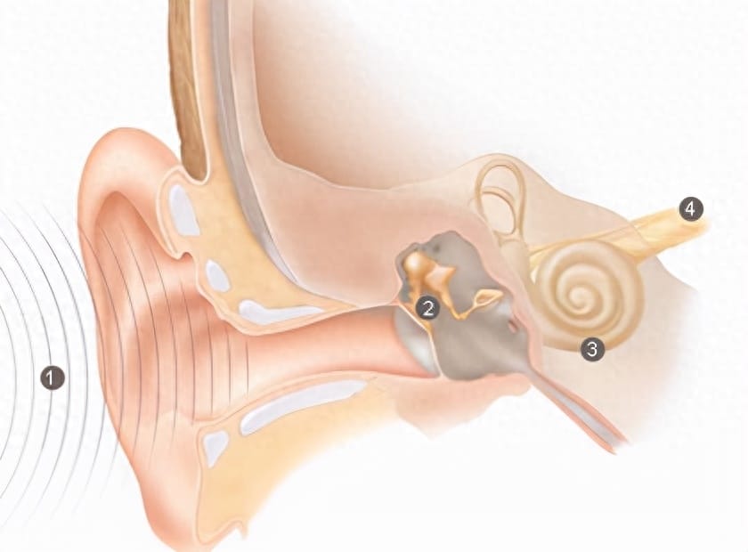 耳塞听歌伤耳吗? 戴耳塞听歌(图2)