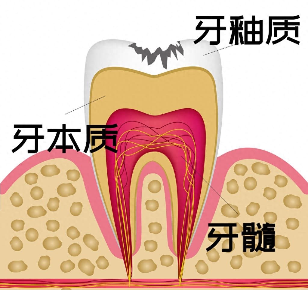 牙齿贴片可以美白牙齿吗 什么是牙齿贴片儿美白(图6)