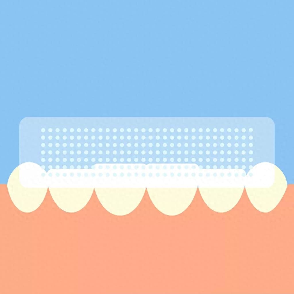 牙齿贴片可以美白牙齿吗 什么是牙齿贴片儿美白(图15)