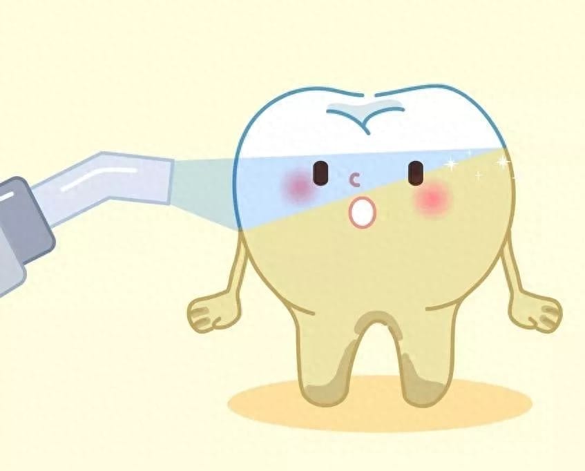 牙齿贴片可以美白牙齿吗 什么是牙齿贴片儿美白(图16)